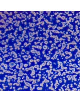 Στόρια Αλουμινίου σφυρήλατα μπλε σειρά 25-413 (Image 1)